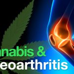 cannabisosteoarthritis