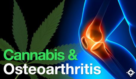 cannabisosteoarthritis