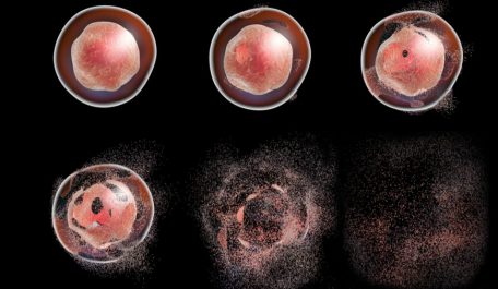 Hóa trị giết cả những tế bào khỏe mạnh – Cần sa chỉ tiêu diệt bệnh ung thư
