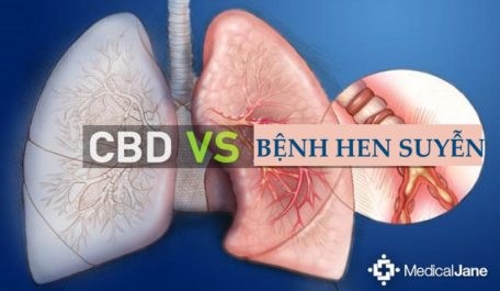 CBD và Hen suyễn