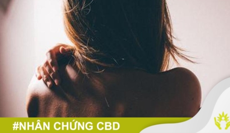 CBD-RSO giúp điều trị bệnh vẩy nến và chàm da