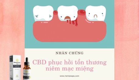 nhan-chung-cbd-giup-phuc-hoi-ton-thuong-niem-mac-mieng