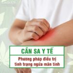 Cần sa y tế - Phương pháp điều trị tình trạng ngứa mãn tính